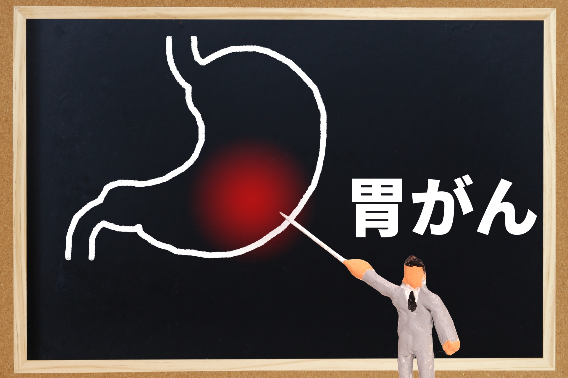 胃がん検診